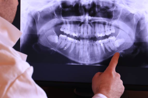 Best Emergency Root Canal Treatment in Oklahoma, PA